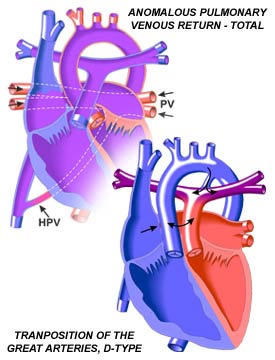 Cyanotic Diseases
