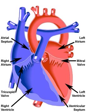 Endocardial Cushion Defect