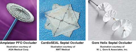 Occlusion Devices