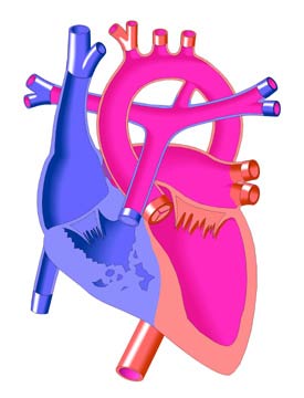 Pulmonary Atresia